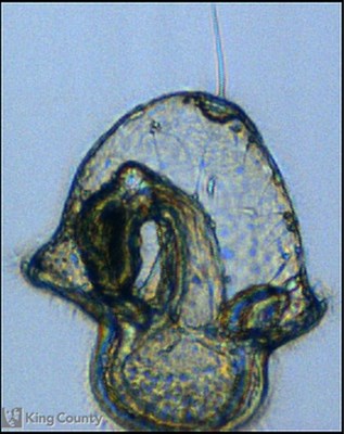 Photo of Nemertea: pilidium larva